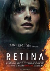 Retina izle